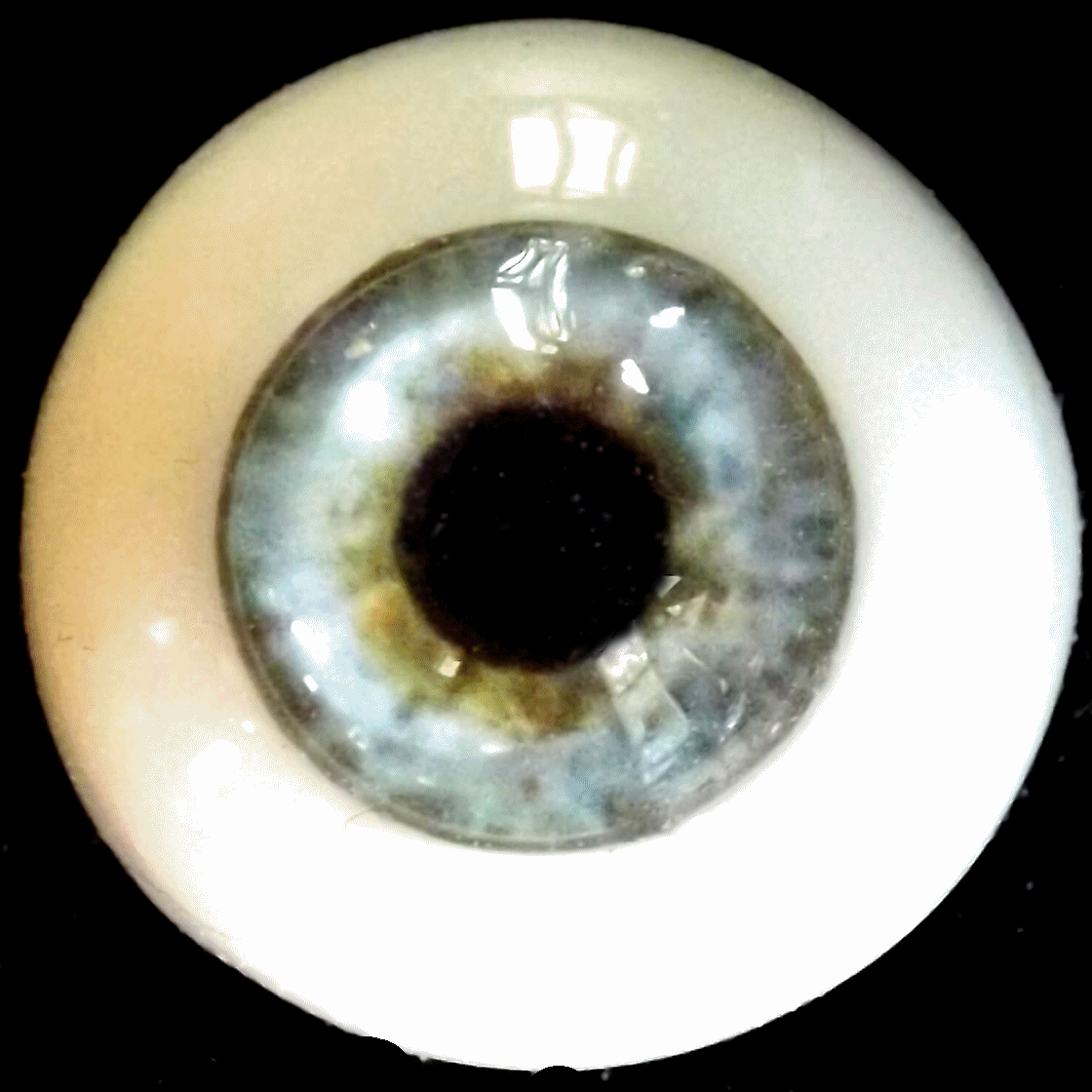 eye