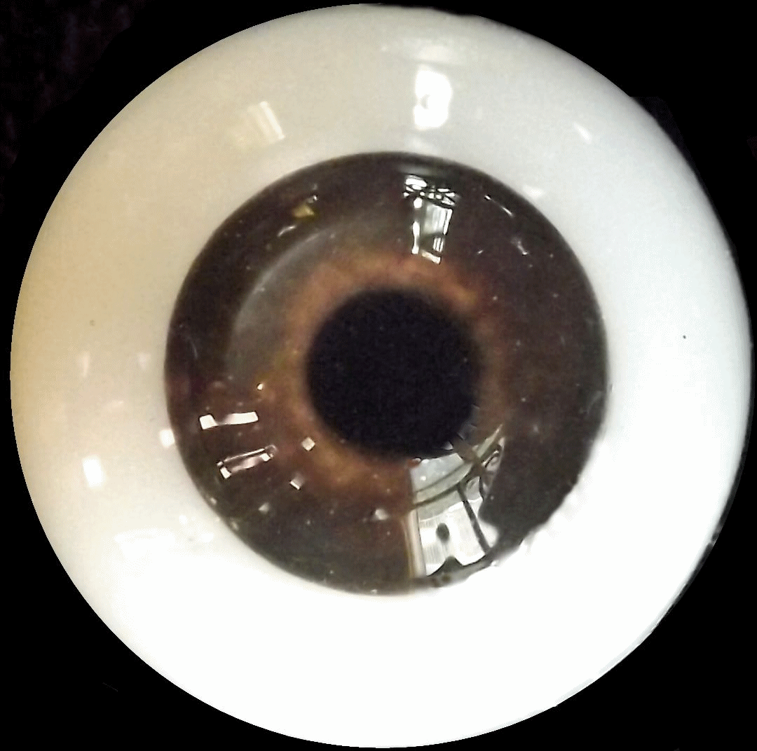 eye