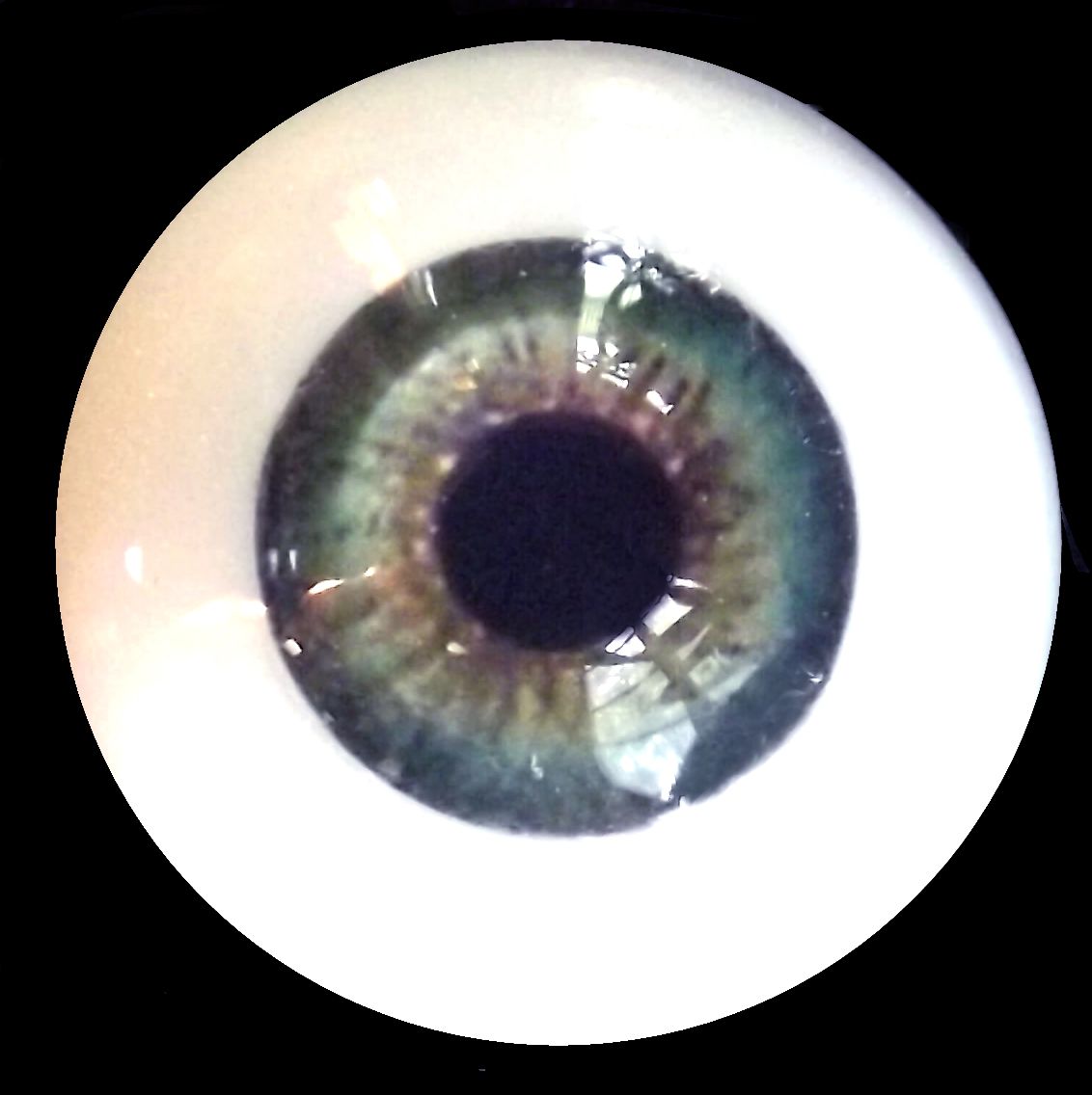 eye